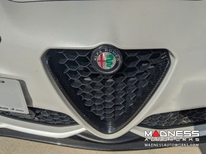 Alfa Romeo Giulia Front V Shield Grill Frame + Emblem Frame Kit - Carbon Fiber